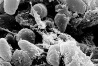 California resident catches the plague, likely from infected flea at Lake Tahoe, officials say