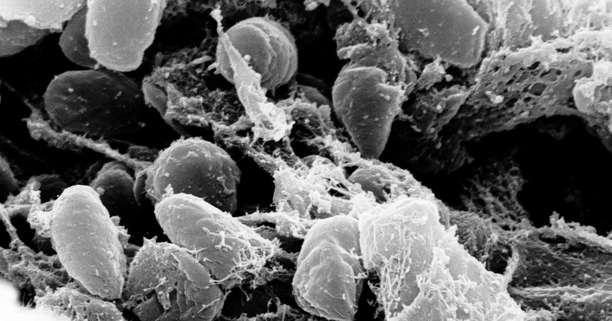 California resident catches the plague, likely from infected flea at Lake Tahoe, officials say